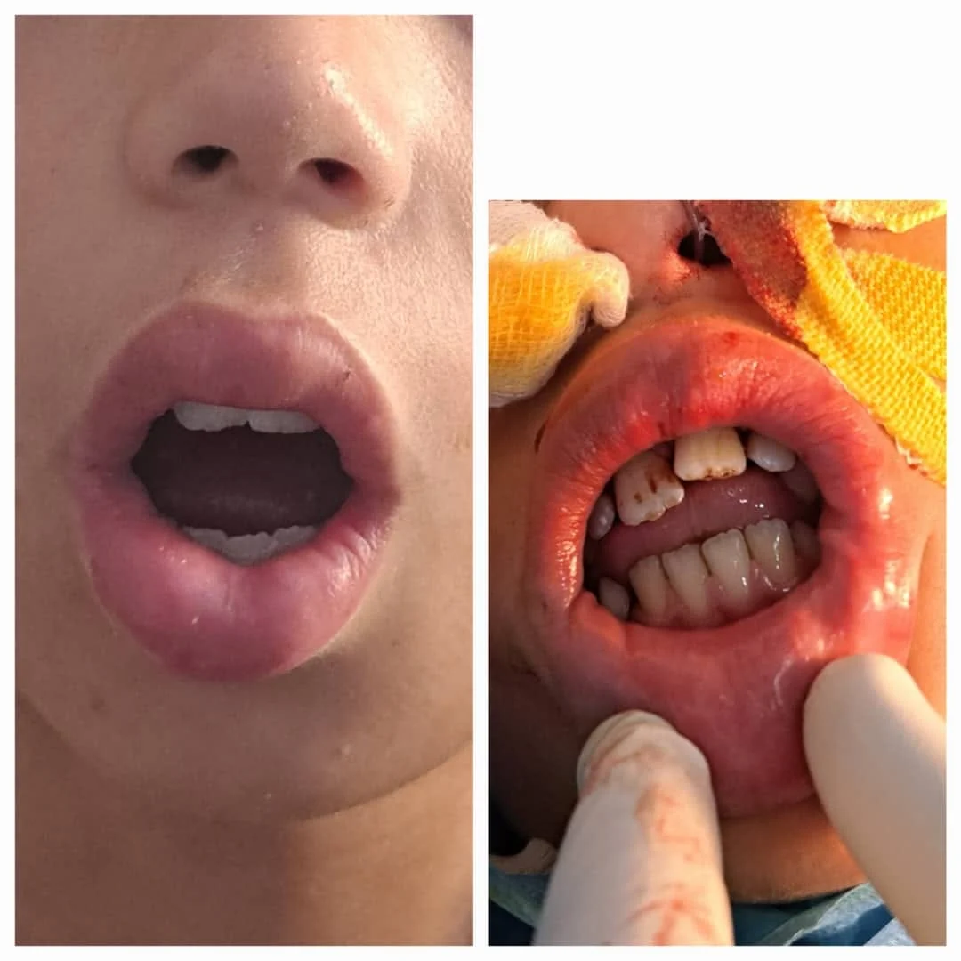 Prouesse médicale en Algérie : un homme retrouve l'usage de sa bouche après 14 ans Prouesse médicale en Algérie : un homme retrouve l'usage de sa bouche après 14 ans