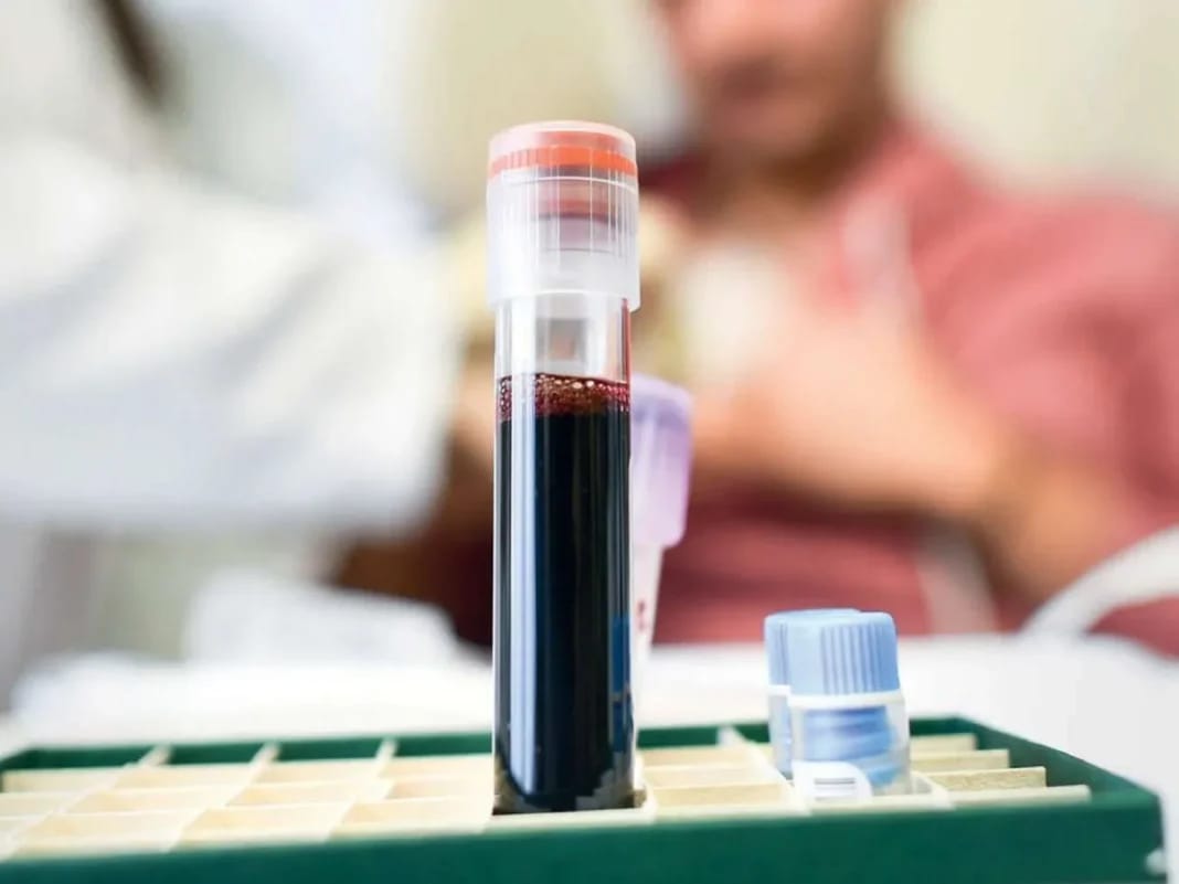 Lutte contre le cancer : le gouvernement algérien fait un pas de géant. Bonne nouvelle pour les patients Test de sang pour le traitement du cancer en laboratoire.