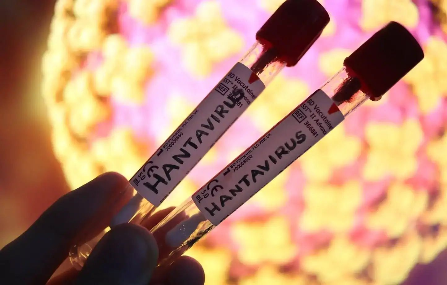 Échantillons de test pour le Hantavirus en laboratoire algérien.