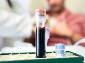 Test de sang pour le traitement du cancer en laboratoire.