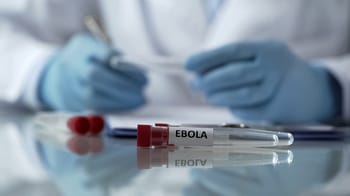 Échantillon de test Ebola avec étiquette sur une table de laboratoire.