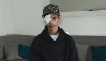 Jeune garçon avec un bandage sur l'œil, assis sur un canapé.