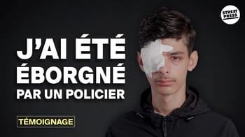 Jeune homme avec un bandage sur l'œil, témoignage d'une blessure grave.