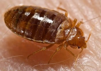 Punaises de lit sur peau humaine, infestation domestique.