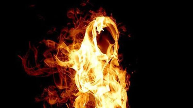 Image de flammes et de brûlure, illustrant un incident grave.