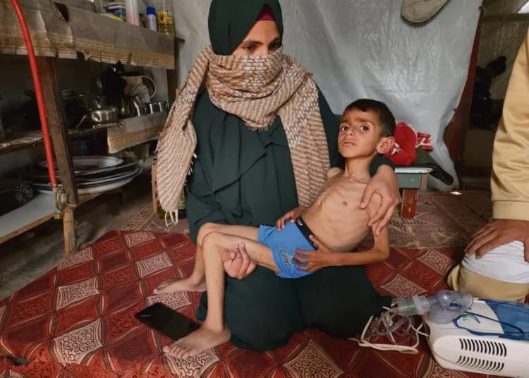 Famine à Gaza : des civils s’écroulent dans les rues sous les yeux du monde entier Famine à Gaza : des civils s’écroulent dans les rues sous les yeux du monde entier